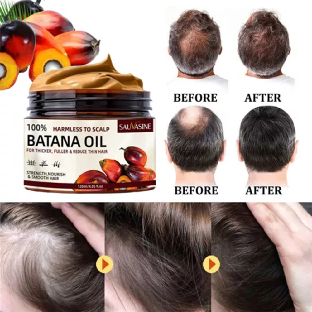 Krim Penumbuh Rambut Batana 12 - Hair Care Dupes ulasan dan harga