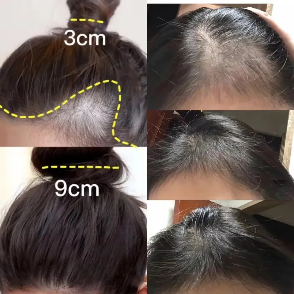 Krim Penumbuh Rambut Jahe Cepa - Hair Care Dupes ulasan dan harga